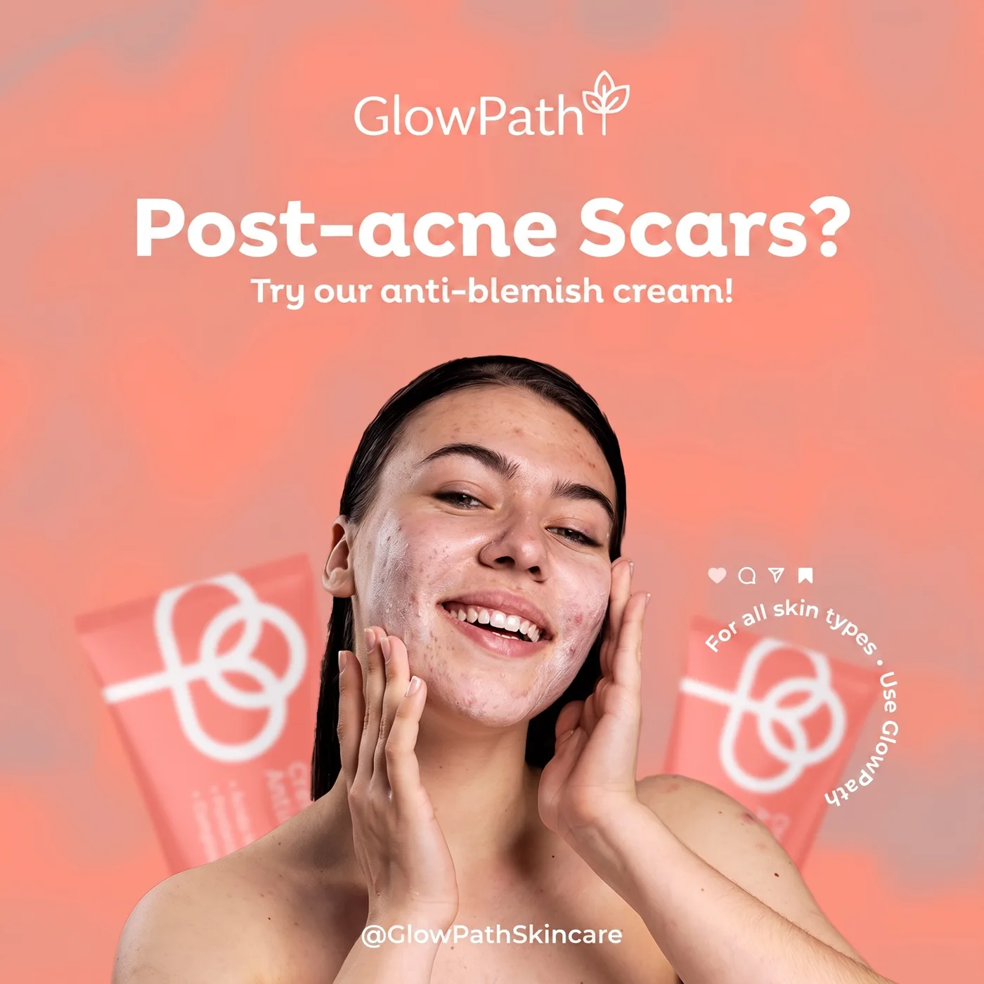 Post-acne Scars — an Instagram post for GlowPath
